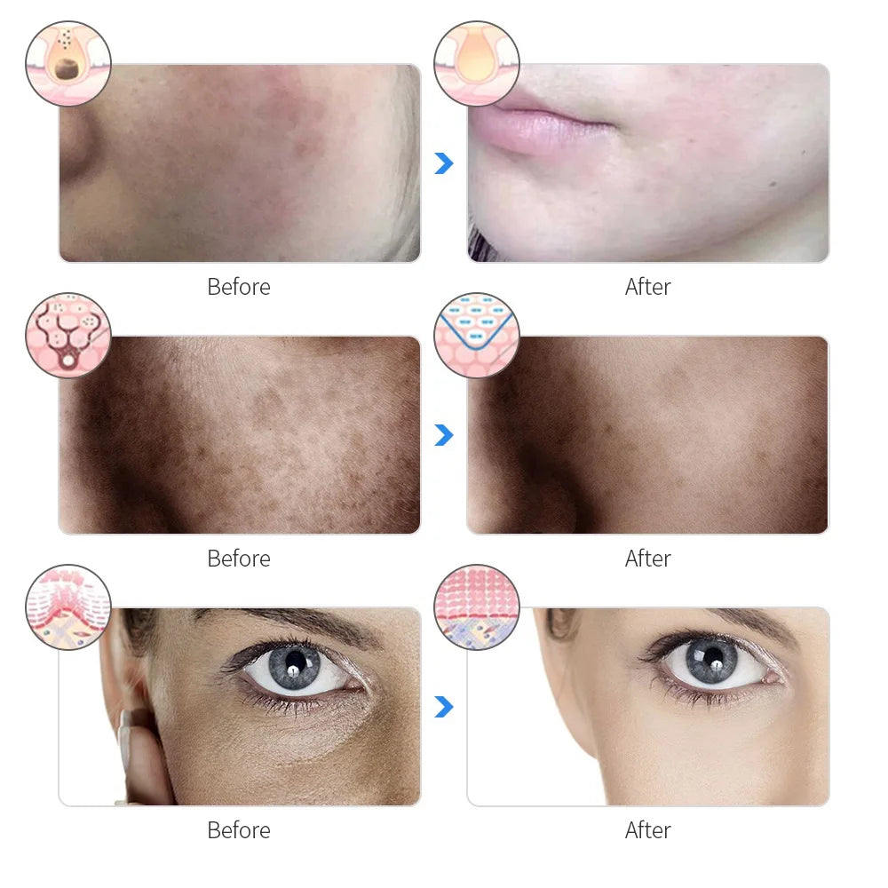 7-Color Radiance Mask | Rechargeable LED Therapy for Instant Lift & Glow